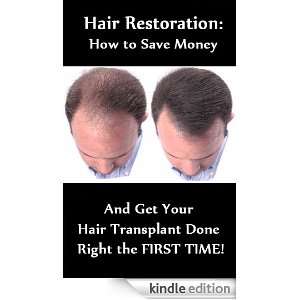 Hair Restoration   How to Save Money and Get Your Hair Transplant Done 