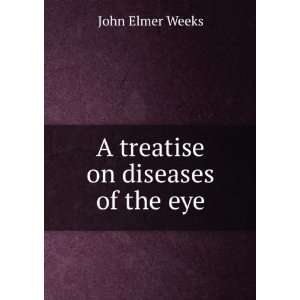  A treatise on diseases of the eye John Elmer Weeks Books