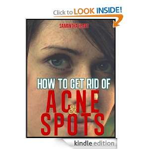 How To Get Rid Of Spots And Acne What Are Spots & Acne And How Are 