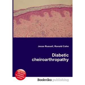    Diabetic cheiroarthropathy Ronald Cohn Jesse Russell Books